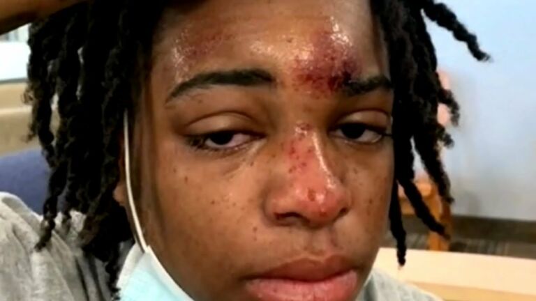 19-year-old student was allegedly beaten by the owner of a bar and nightclub in Illinois in what her attorneys described as a “racist attack.” 19-year-old student was allegedly beaten by the owner of a bar and nightclub in Illinois in what her attorneys described as a “racist attack.”